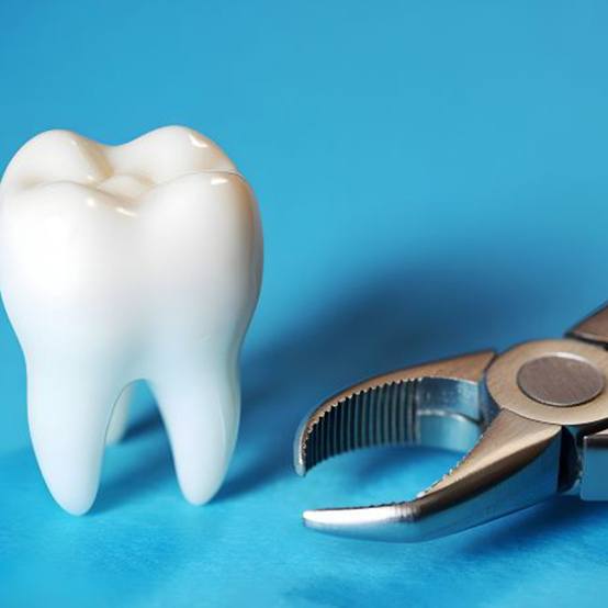 Tooth model next to dental forceps