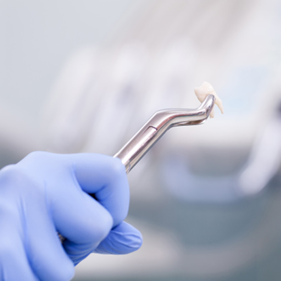 Gloved hand holding forceps and extracted tooth