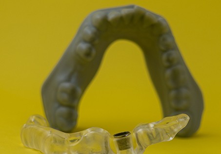 Tooth model behind dental implant surgical guide
